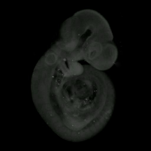 3D computer representation of a theiler stage 15 mouse embryo in situ hybridized with a wnt 10a probe