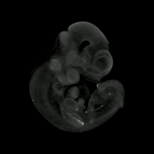 3D computer representation of a theiler stage 17 mouse embryo in situ hybridized with a wnt 10a probe