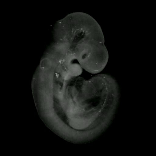 3D computer representation of a theiler stage 15 mouse embryo in situ hybridized with a wnt 10b probe