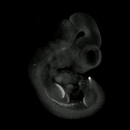 3D Computer represntation of a theiler stage 17 mouse embryo in situ hybridized with a wnt 10b probe