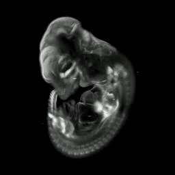 3D computer reconstruction of a mouse embryo in situ hybridized with a Wnt 11 probe side view