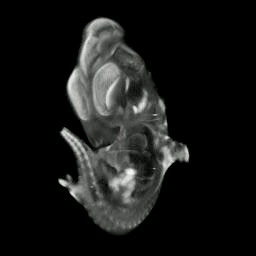 3D computer reconstruction of a mouse embryo in situ hybridized with a Wnt 11 probe 45 degree view