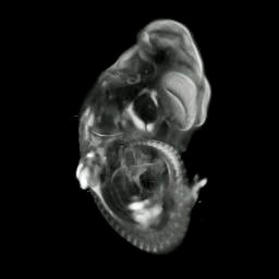 3D computer reconstruction of a mouse embryo in situ hybridized with a Wnt 11 probe,45 degree view