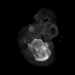 3D computer representation of a theiler stage 17 mouse embryo in situ hybrdized with a wnt 2 probe