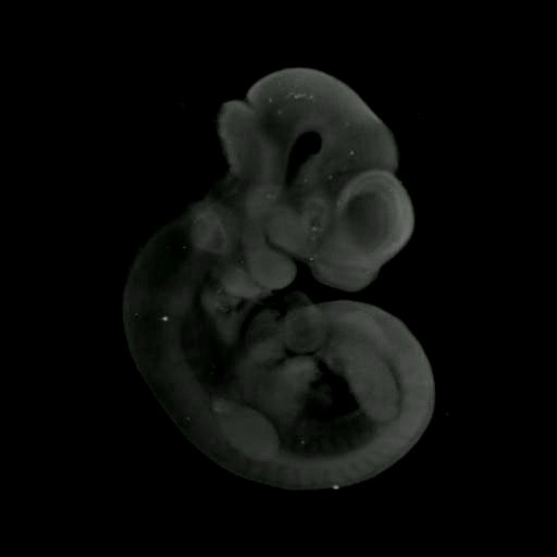 3D computer representation of a theiler stage 17 mouse embryo in situ hybridized with a Wnt3A probe