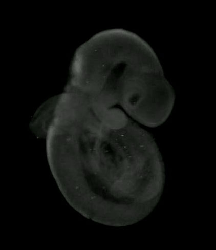 3D computer representation of a theiler stage 15 mouse embryo in situ hybridized with a wnt 3 probe