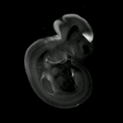 3D computer represenation of a theiler stage 17 mouse embryo in situ hybridized with a wnt 3 probe