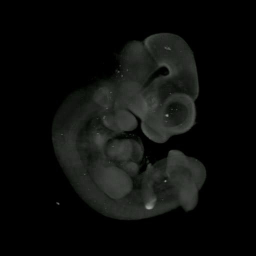 3D computer representation of a theiler stage 17 mouse embryo in situ hybridized with a wnt 5b probe