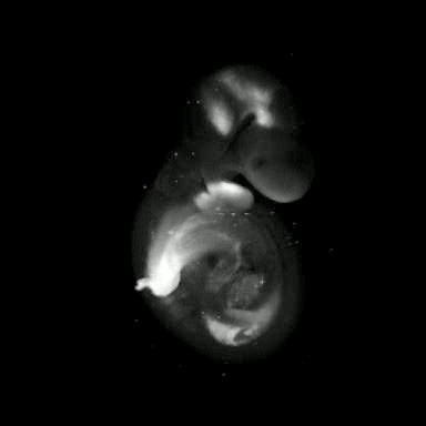 3D computer representation of a theiler stage 15 mouse embryo in situ hybridized with a wnt 5a probe