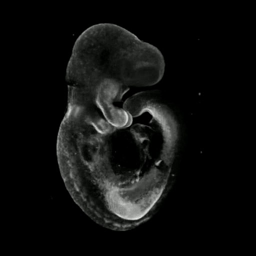 3D computer representation of a theiler stage 15 mouse embryo  in situ hybridized with a wnt 6 probe