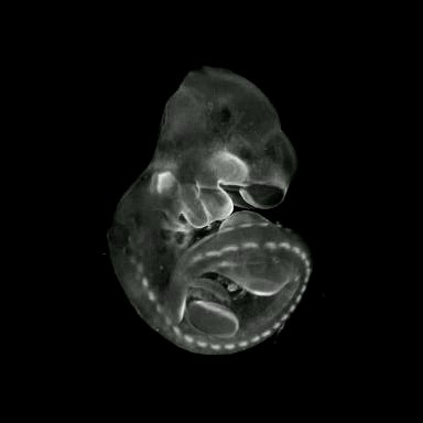 3D computer representation of a theiler stage 17 mouse embryo  in situ hybridized with a wnt 6 probe
