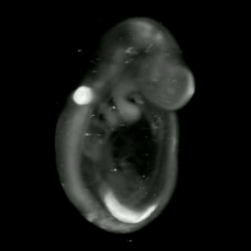 3D computer representation of a theiler stage 15 mouse embryo in situ hybridized with a wnt 7a probe