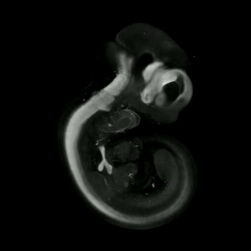 3D computer representation of a theiler stage 17 mouse embryo in situ hybridized with a wnt 7b probe