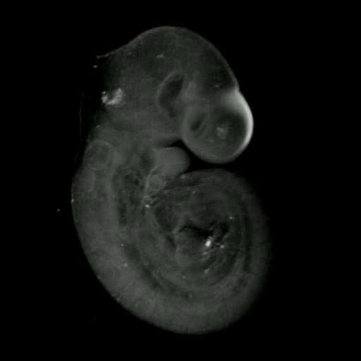 3D computer representation of a theiler stage 15 mouse embryo in situ hybridized with a wnt 8b probe