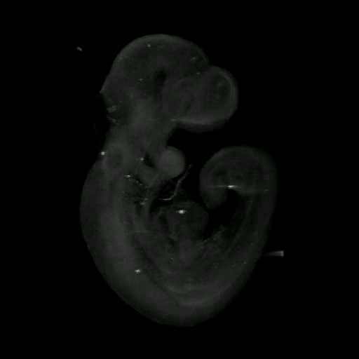 3D computer representation of a theiler stage 15 mouse embryo in situ hybridized with a wnt 9a probe