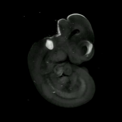 3D computer representation of a theiler stage 17 mouse embryo in situ hybridized with a wnt 9a probe