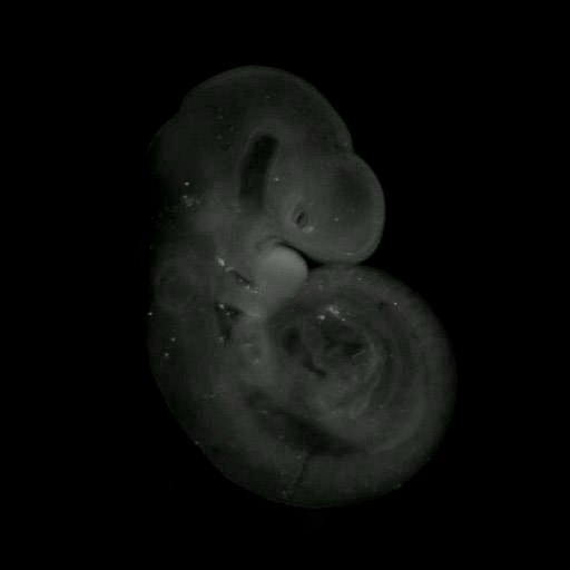 3D computer representation of a theiler stage 15 mouse embryo in situ hybridized with a wnt 9b probe