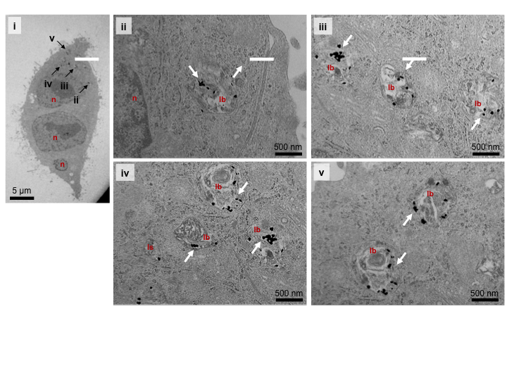 Source:Dania Movia, Valerie Gerard, Ciaran Manus Maguire, Namrata Jain, Alan P. Bell, Valeria Nicolosi, Tiina O’Neill, Dimitri Scholz , Yurii Gun’ko, Yuri Volkov, Adriele Prina-Mello., Biomaterials (2014),