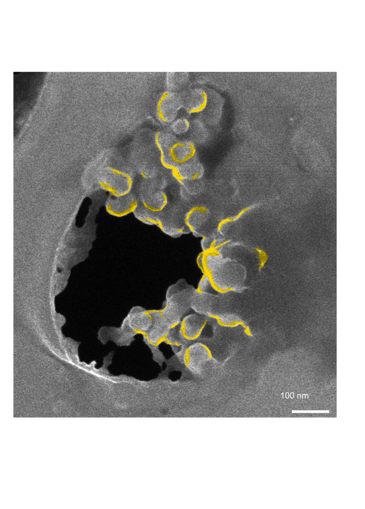 Source:Dania Movia, Valerie Gerard, Ciaran Manus Maguire, Namrata Jain, Alan P. Bell, Valeria Nicolosi, Tiina O’Neill, Dimitri Scholz , Yurii Gun’ko, Yuri Volkov, Adriele Prina-Mello., Biomaterials (2014),